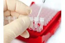 Eritrosit Mikroskopisi Nedir ve Nasıl Yapılır?