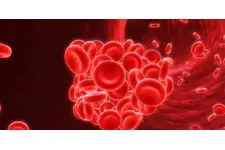 İdrarda Eritrosit Görülmesi Neden Olur? İdrarda Eritrosit Görülmesi Neden Olur?