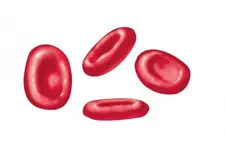 İdrarda Eritrosit Yüksekliği Belirtileri ve Tedavisi İdrarda Eritrosit Yüksekliği Belirtileri ve Tedavisi