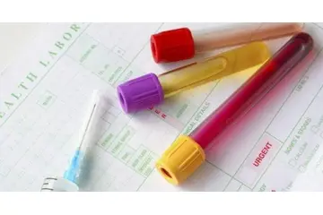 Ortalama Eritrosit Hacmi Düşüklüğü Belirtileri ve Tedavisi