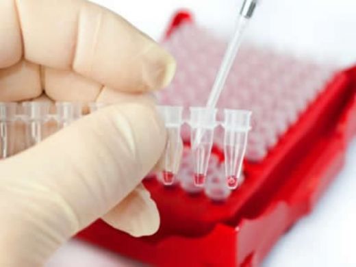 Eritrosit Mikroskopisi Nedir ve Nasıl Yapılır?