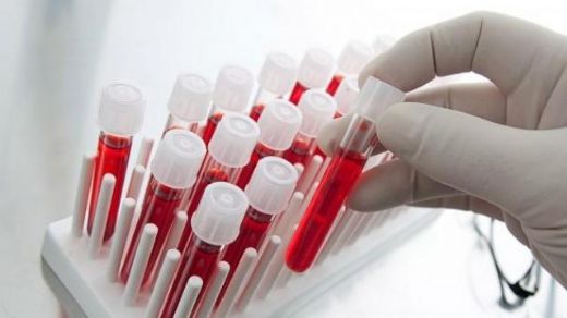 Eritrosit Normal Değerleri Nelerdir?