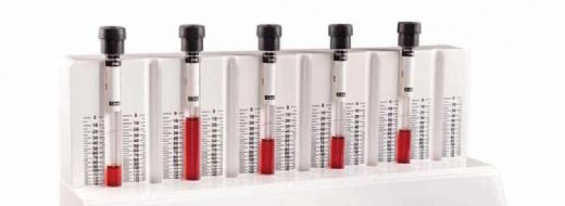 Eritrosit Sedimentasyon Hızı