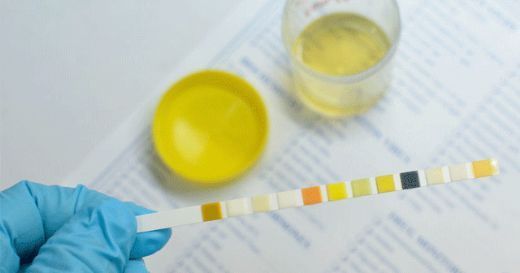 İdrarda Eritrosit Değeri Kaç Olmalı?