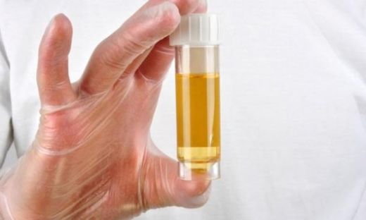 İdrarda Lökosit ve Eritrosit Normal Değerleri