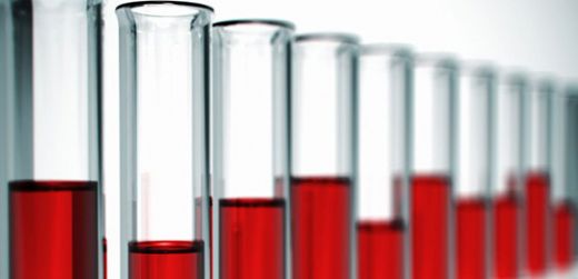 Kanda Eritrosit Yüksekliği Belirtileri ve Tedavisi